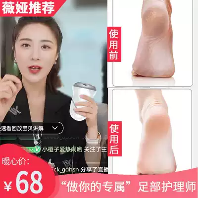 Foot grinding artifact exfoliating foot grinding device electric calluses automatically remove dead skin from the feet, scrape the heels, vacuum the soles of the feet, pedicure
