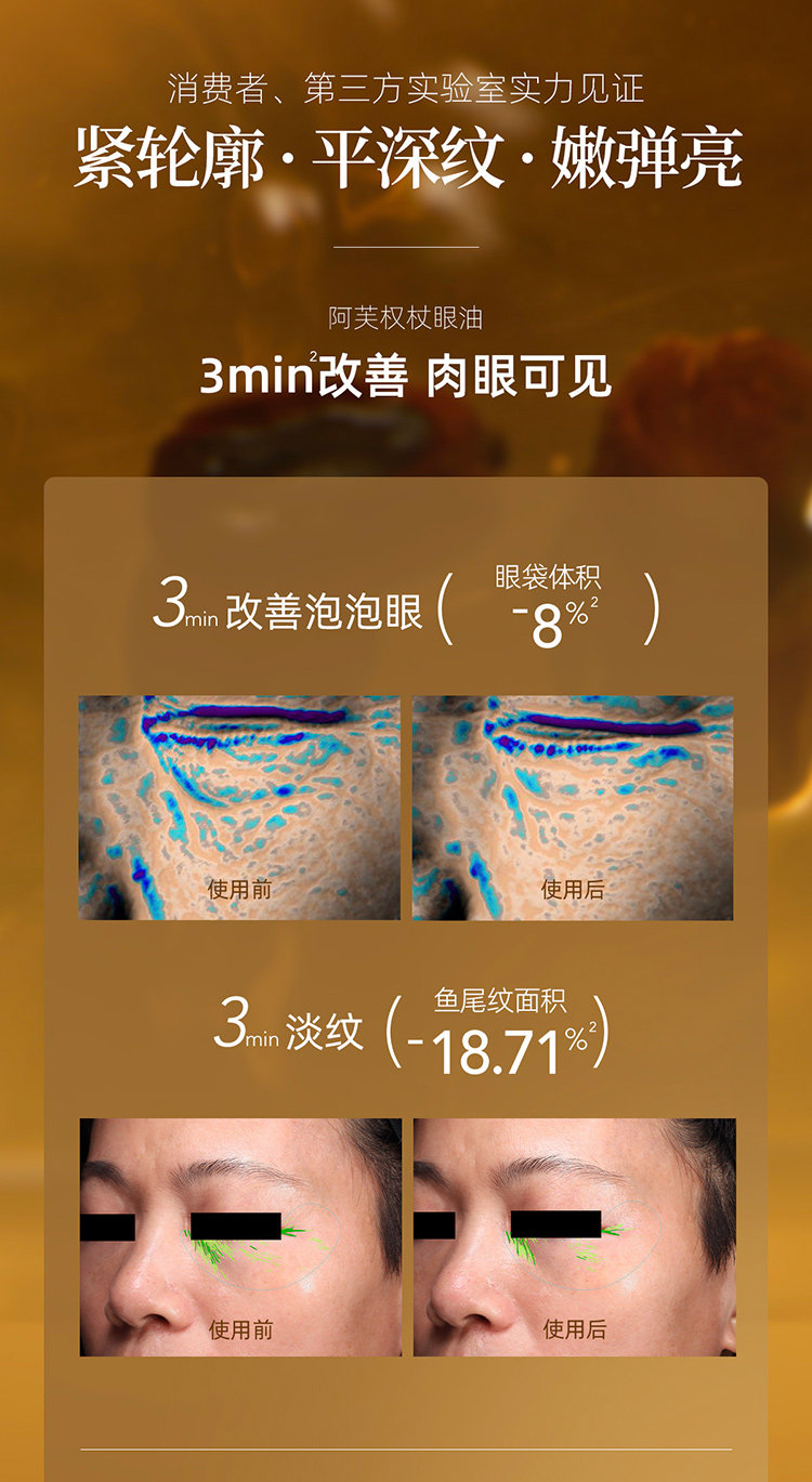 【香港直郵】 阿芙 11籽眼油淡紋精華油10ml 保濕抗皺 淡化眼袋 緊緻眼周 精油養護【董潔力薦】