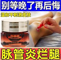 Special ointment for diabetic foot ulcers Special ointment for foot ulcers and wounds to promote flesh growth Special ointment for erysipelas