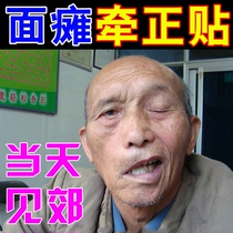 Facial paralysis special medicine holding paste Paste Metallurgical suspension line Wind Facial Paralysis Sequelae Stiff Crammy Mouth Crooked Eyesdrop Recovery Theorizer