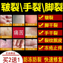 Read the Kirin Skin Care Cream Inexhaustible Hand Foot Dry Cracked Rhagheme Heel Moisturizer official Netcom Frost Crack Repair Cream-Flagship Store