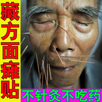 Facial paralysis sticking with positive plasters facial cramps Vulgar Numb Cramps Nerve Recovery Sticking Mouth Crooked Eye-back Sequelae Recovery