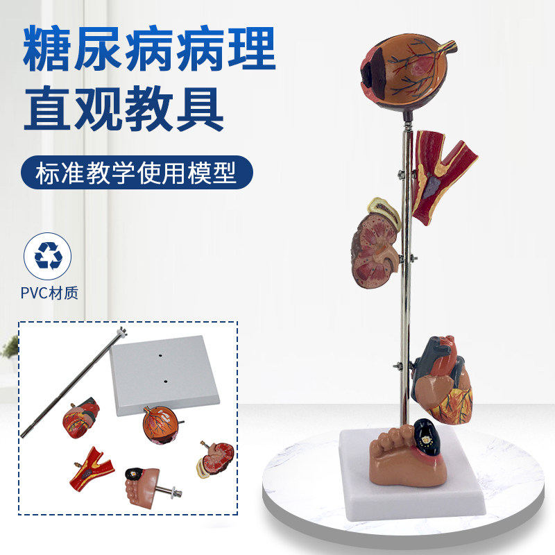 糖/尿病 高/血压模型 高血压病理变脑眼心脏肾脏血管内脏模型G3