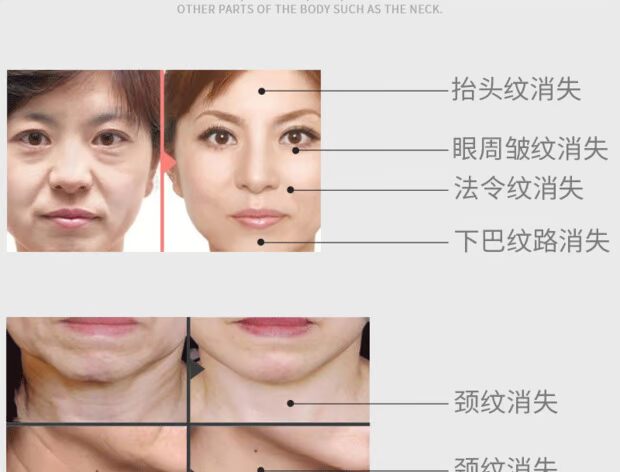 Counter chính hãng Yun Jinxi Yeast Revitalizing Cream Nâng cơ Firming Skin Massage Giới thiệu Giữ ​​ẩm Giữ ẩm - Kem massage mặt kem massage mặt chuyên dụng cho spa