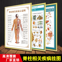 Spine-related diseases human Meridian and acupoint map large wall chart Chinese medicine health pictures poster beauty salon poster