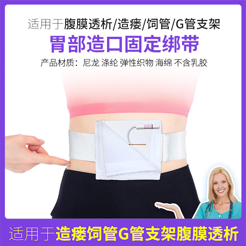 胃部引流导管腹膜透析造瘘饲管G管支架胃部造口术胃管固定带绑带