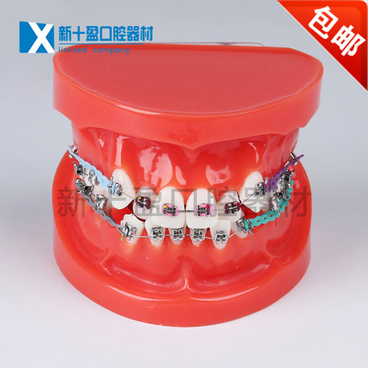 Dental Oral Dental Mold Red Misjaw With Bow Wire Dental Dental Misjaw Model Doctor-patient Communication 