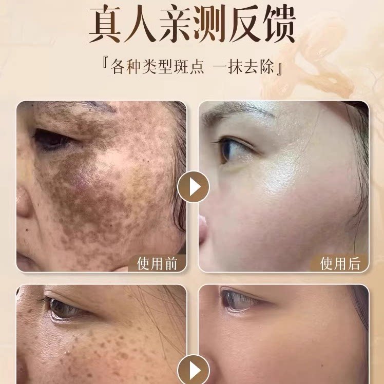 硬核实测:柔迪思祛斑霜到底值不值得买?_乳液_淘宝美妆网