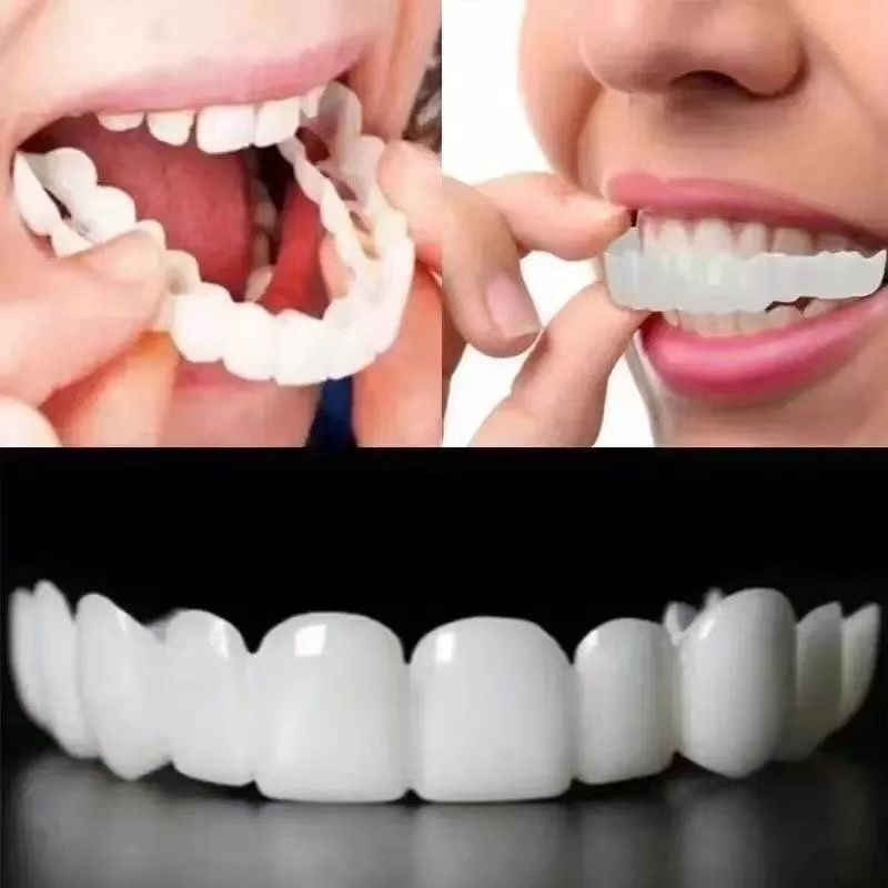 Tooth Slit Large False Tooth Braces Imitation Real False Tooth Slit Filling God Instrumental Door Dental Stitch Straightener Big of Tooth Braces-Taobao