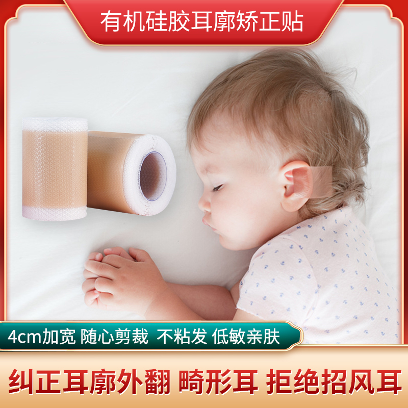 Newborn Ear Corrector Silicone Ear Patch Baby Deformity Pinna Baby Beckoning Ear Correction Fixing Artifact