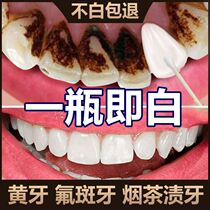 Quick-impact teeth Go to the yellow and white theorist shake-up whitening to smoke stains Fluorplaque Dental Plaque Teeth Scale White Teeth Oral Cleaning