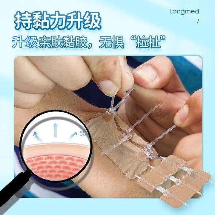 胶布减张贴疤痕医用皮肤儿童伤口免缝合贴胶水创口贴拉链式减张器