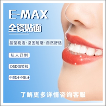 Teeth Veneers Full Ceramic Teeth Veneers Ivoclar Full Porcelain Teeth Veneers Teeth Veneers Full Porcelain Teeth Veneers Whitening Teeth Patch