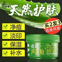 Tiger dart 95% natural aloe vera gel remove acne water moisturizing cream scar youth fade female men