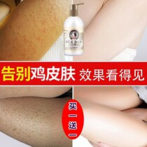 After a bath body lotion foot milk peeling air conditioner dry skin anti-leg skin itching hydrating calf