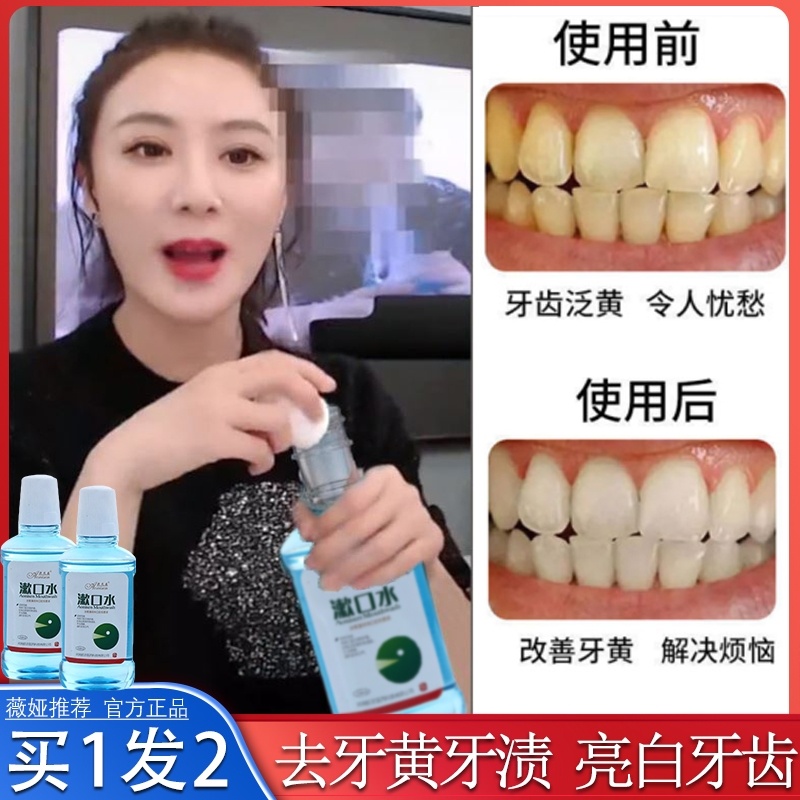 Dental calculus dissolving mouthwash Weya recommended portable sterilization in addition to bad breath Anti-whitening inflammation Ms starry sky antibacterial