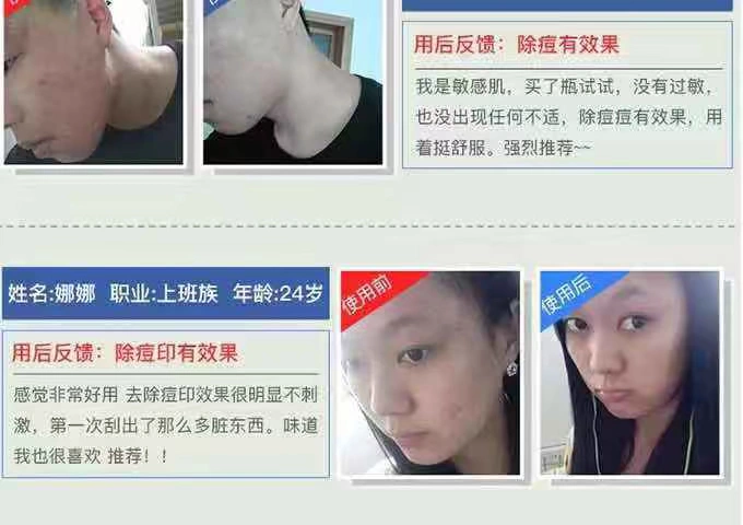 Làm xanh da thủy tinh trẻ hóa da làm sạch sâu lỗ chân lông Kem massage mặt làm sạch da mặt - Kem massage mặt kem massage mặt spa