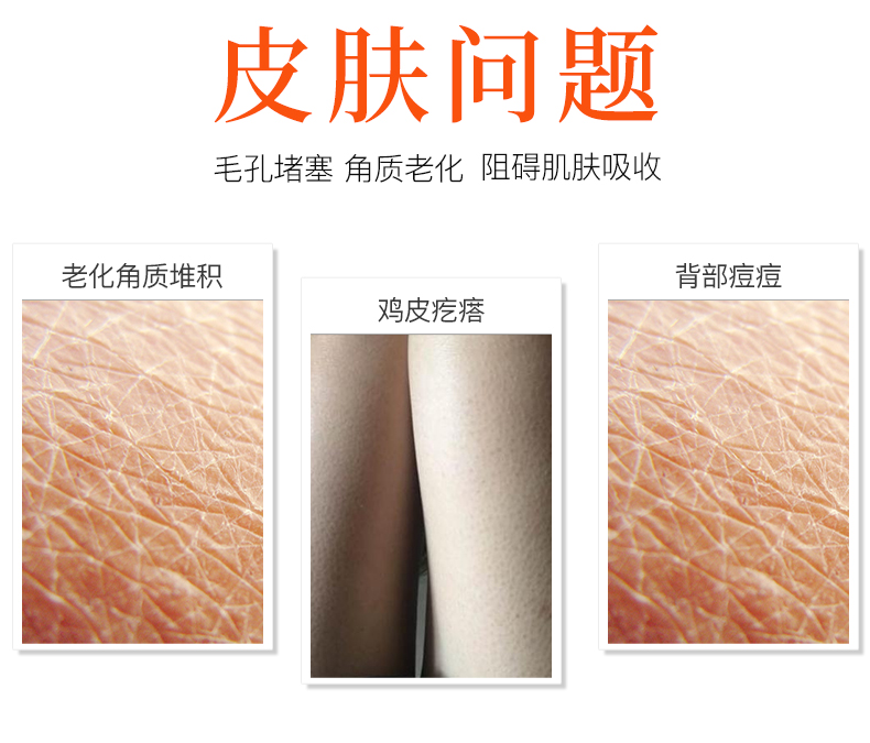 Tẩy tế bào chết da gà mặt cơ thể phụ nữ tay chân mặt tắm nước muối rửa mặt làm sạch để mụn đầu đen không tẩy tế bào chết tẩy da chết cho da dầu mụn