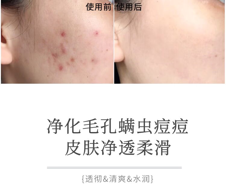 Ru Runtang sữa dê xà phòng handmade xà phòng mặt xà phòng dưỡng ẩm tự nhiên tinh dầu làm sạch tinh khiết tắm nam và nữ đích thực - Tinh dầu điều trị tinh dầu hoa ngũ sắc
