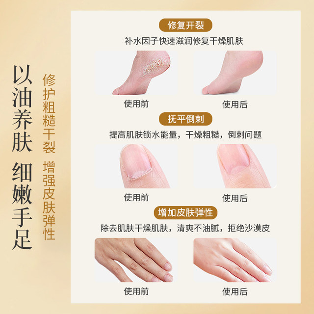 Three Flowers and Three Seeds Hand Protection Essential Oil Hand Cream Moisturizing Moisturizing and Hydrating Anti-Crack Barbs Glycerol Cracks Finger Edge Oil Rolling Balls