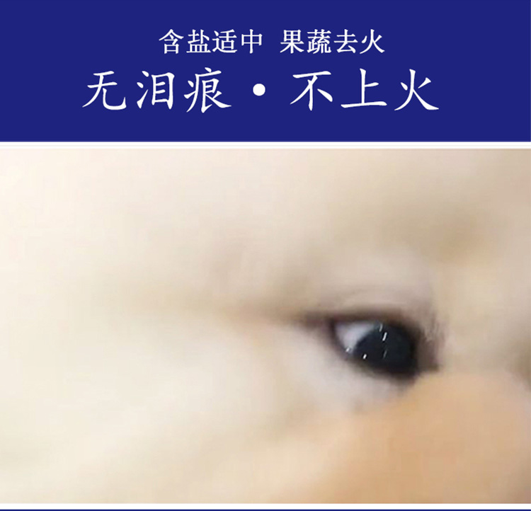 Bei Nengxing chất lượng cao thức ăn cho chó lớn chó nói chung cải thiện hạt nước mắt tăng cường miễn dịch 10 kg tải Quan Gia - Chó Staples thức ăn cho chó zenith