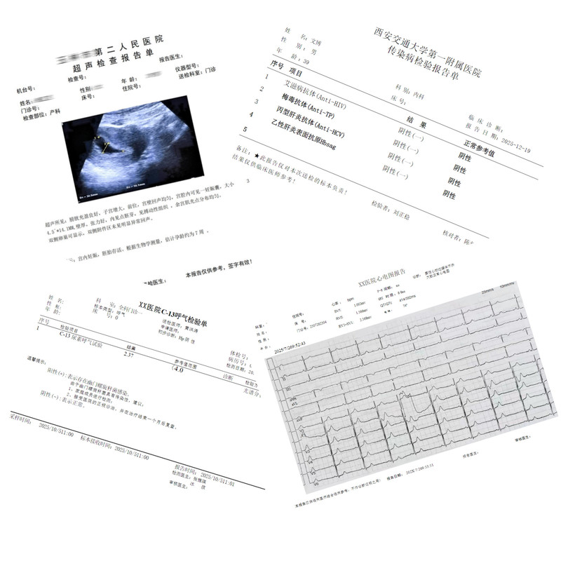Electronic Version of the Inspection Report Form, Universal Template Collection, Forms That Need to Be Edited and Printed by Yourself, Non-Paper-Based