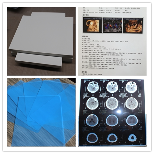 Medical film B5x light blue inkjet hospital printing film x-ray A4 special high-definition dry film
