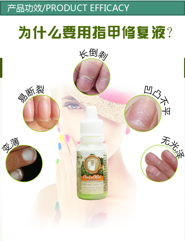 Chất lỏng tăng trưởng móng tay của Nga Người lớn khuyến mãi sửa chữa tay và chân ngón tay chăm sóc móng tay bút dầu dinh dưỡng - Sơn móng tay / Móng tay và móng chân nail cho da ngăm