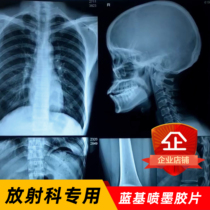 Medical film inkjet blue film X-ray DR CR CT radiology orthopedics dental MRI printing film