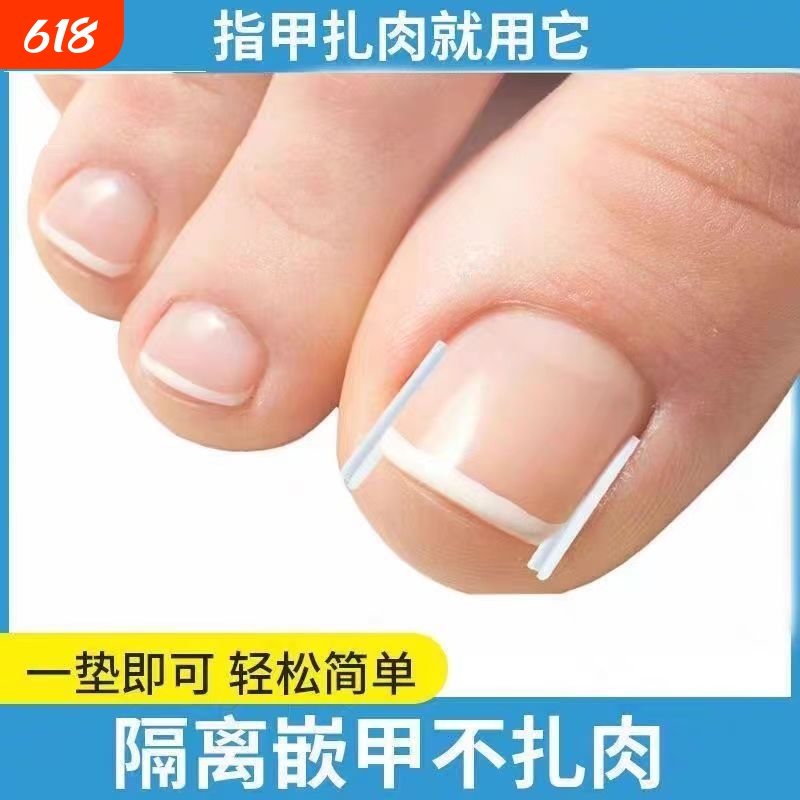 Nail Groove Pads, Ingrown Toenail Corrector, Filling Pads, Nail Correction Stickers, Special Nail Clippers for Toenails Growing into the Flesh, Cotton