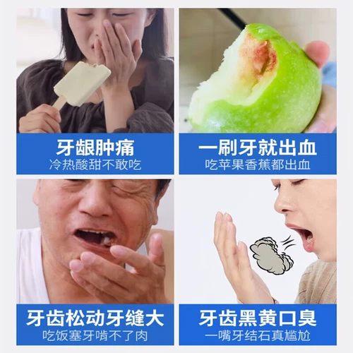 李时珍 Стоматологический сепаратор десны Атрофия восстановления зубов, ослабление зубов, фиксация зубов и антикариозная десенсибилизация Маленькая серебряная трубка xx