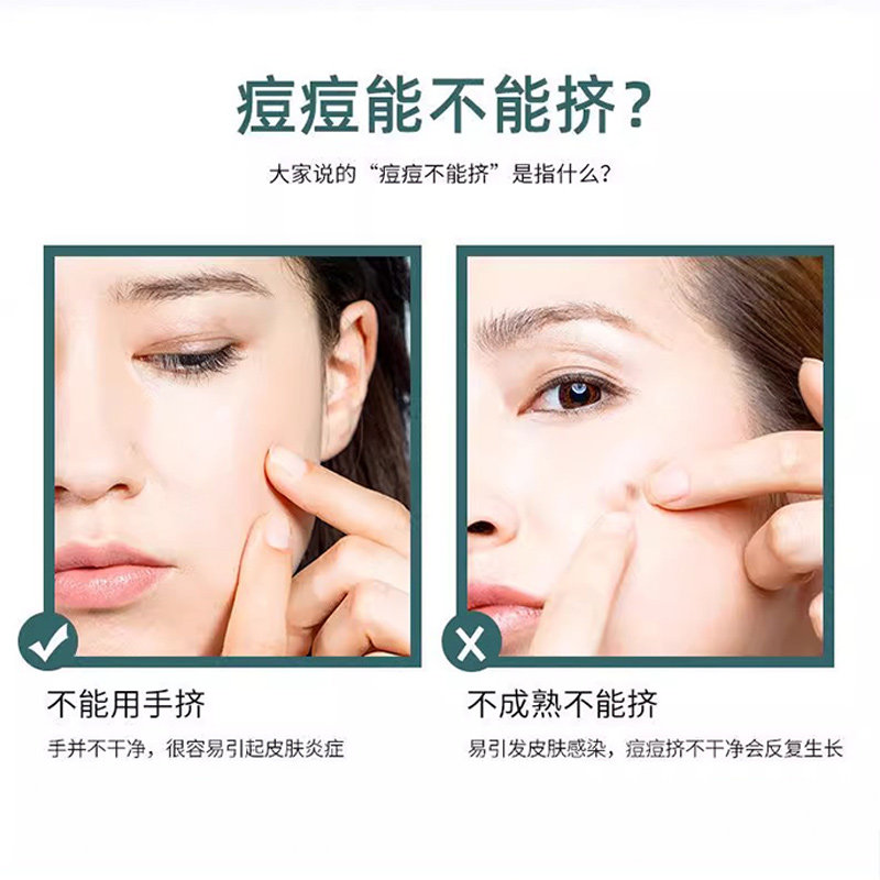 专业细胞夹黑头夹镊子暗疮针超细粉刺针套装挤痘痘工具美容院专用 4