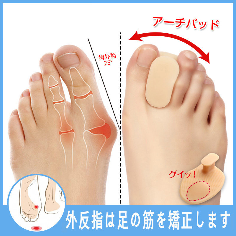 Japan pain-free thumb valgus aligner day and night with shoes able to wear shoes adult male and female big toe and toe osteotoe