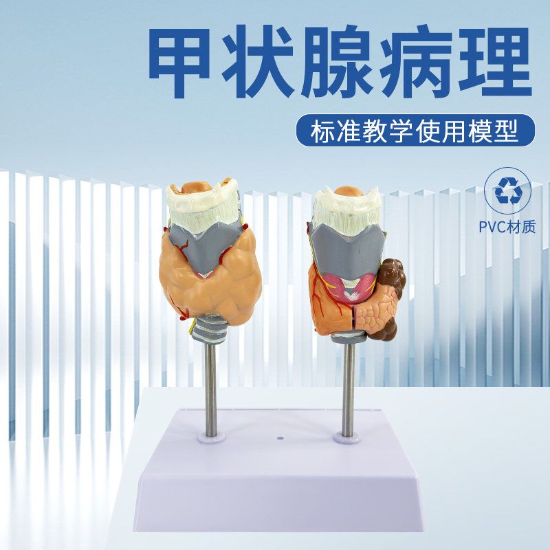 甲状腺病变模型 甲状腺病理模型 甲亢 甲低 甲减 人体内分泌系统