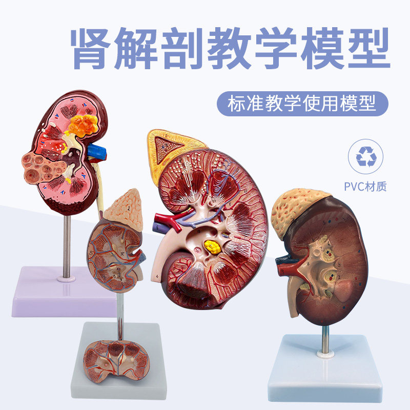 仿真人体肾解剖模型 病变肾脏 肾 放大 内脏器官医学解剖模型教具
