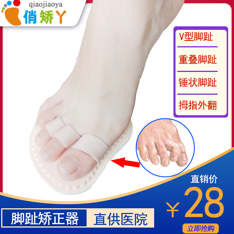 Overlapping toe braces children's thumb valgus correction pad hammer toe V-shaped toe strap can wear shoes