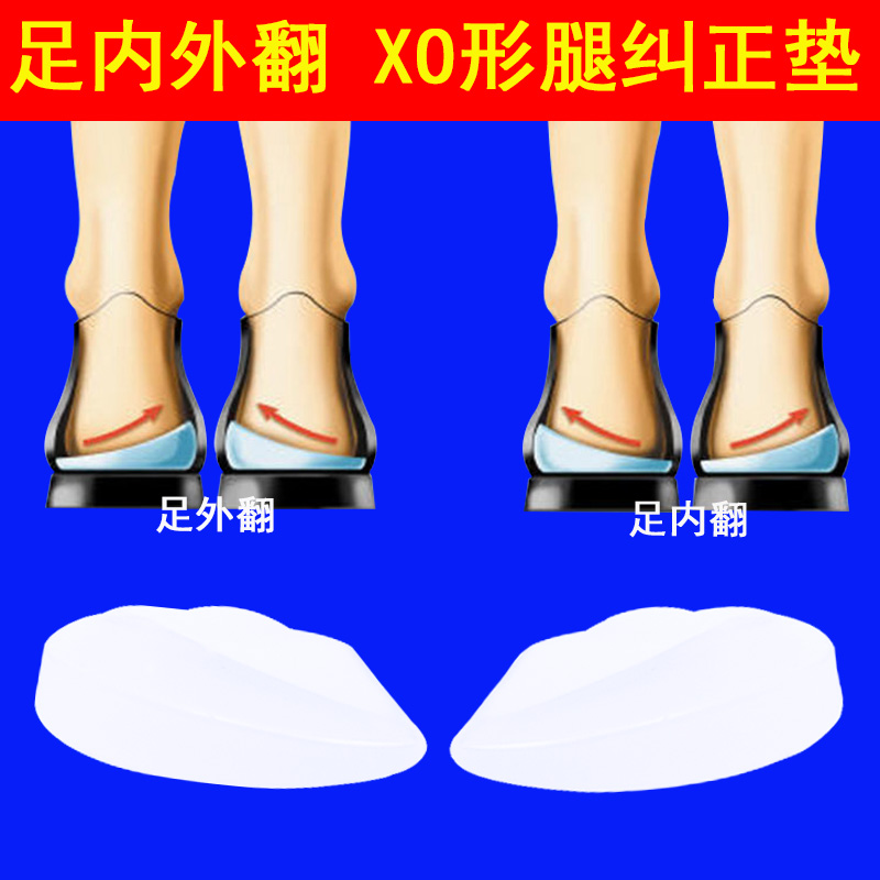 Qiaojiaoya heel inversion correction pad adult XO-type leg correction half-yard pad knee internal rotation children's adjustment pad