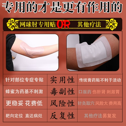 Теннисный локоть специфичный для медицины крем для лечения локоть боль в теннис