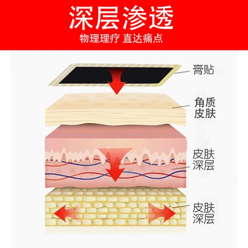 Крем фасции фасции, фасция, фасция, кость на пятке, покалывание ахиллесо