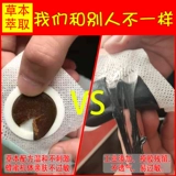 Высший фарингит Хронический фарингит, бог фарингеальные наклейки с плоскими акупунтами, фильтр датчиков, гипертрофия фильтра датчика, гипертрофия