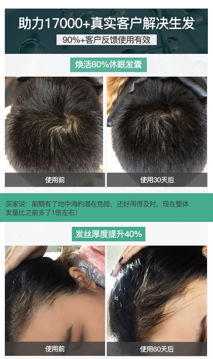 加拿大原装进口 Marc Anthony 防脱育发增长液 135mL 图6