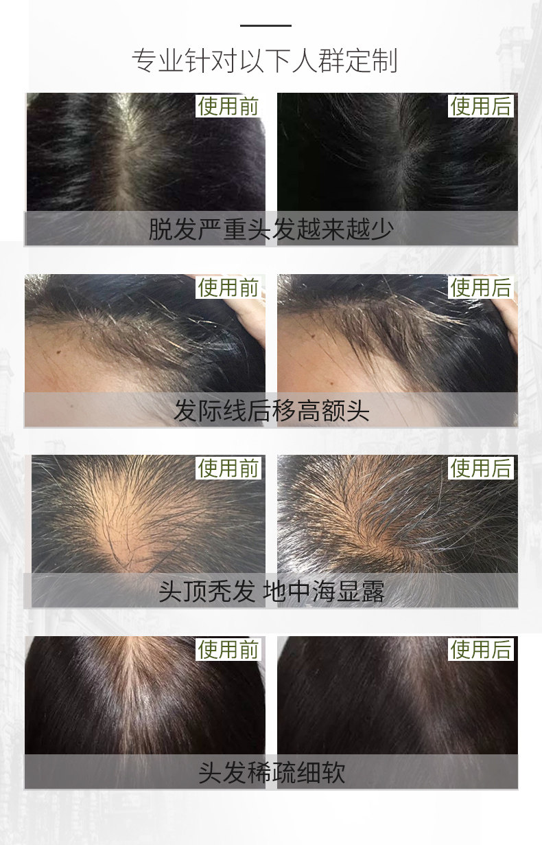 加拿大原装进口 Marc Anthony 防脱育发增长液 135mL 图5