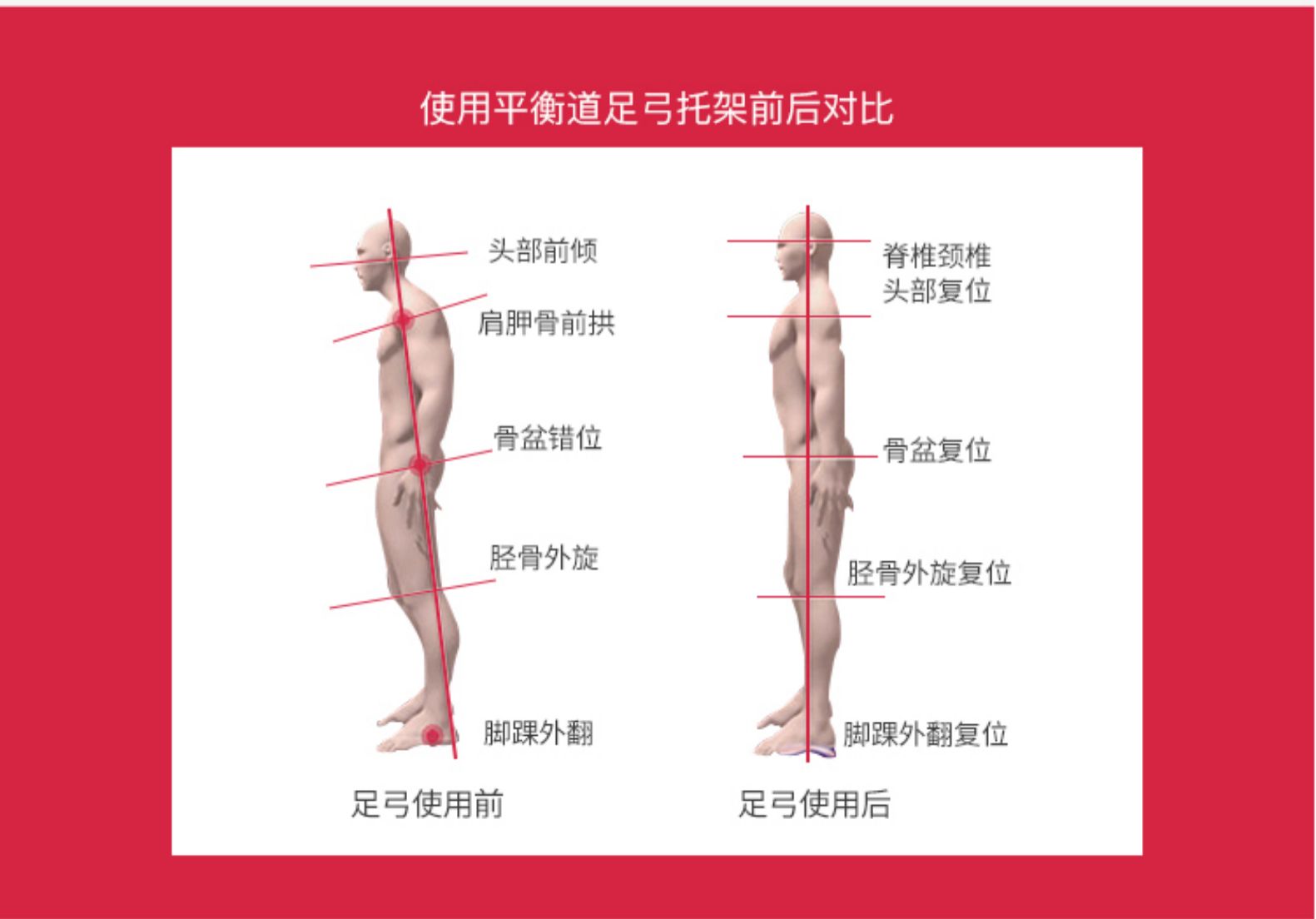 平衡道 扁平足专用矫正器 图10