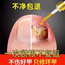 Suitable for those who are impatient (refundable if not purified). Just drop a drop of it to turn bad nails into good ones. Use potassium to cleanse your nails and enjoy a good nail life.