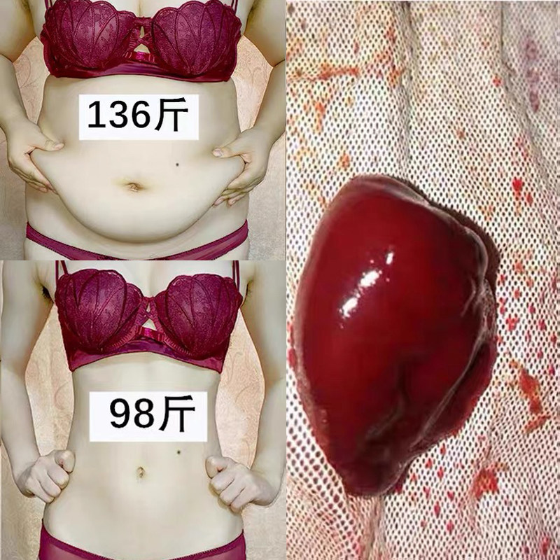 Li Jiaqi recommends rapid tripling to solve many years of troubles, fast and thin, thick arms and legs to change the bluff