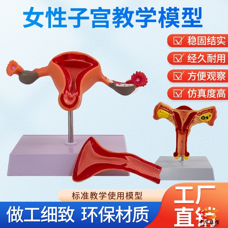 子宫卵巢病理病变 生殖科病理妇科子宫解剖模型 女性子宫病理模型