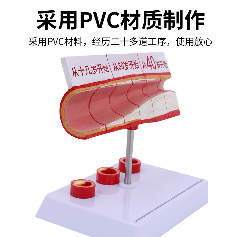 血管 人体血管解剖模型 各阶段年龄层血管展示模型 大型血管展示