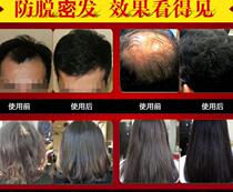 Raw hair reveless multihair growth liquid Zhangzhang light increasing hair loss water anti-ginger shampoo for men and women Mie control oil 101