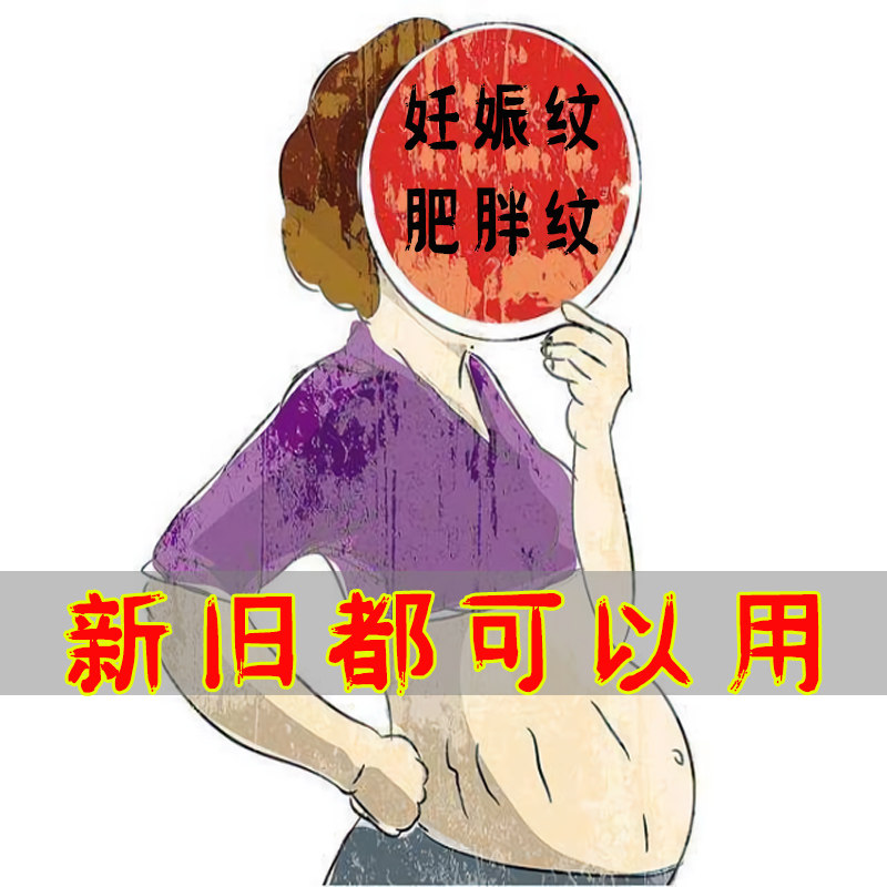 (Hot sale 178 three boxes a course) remove stretch marks and fade obesity tattoo artifacts for postpartum use