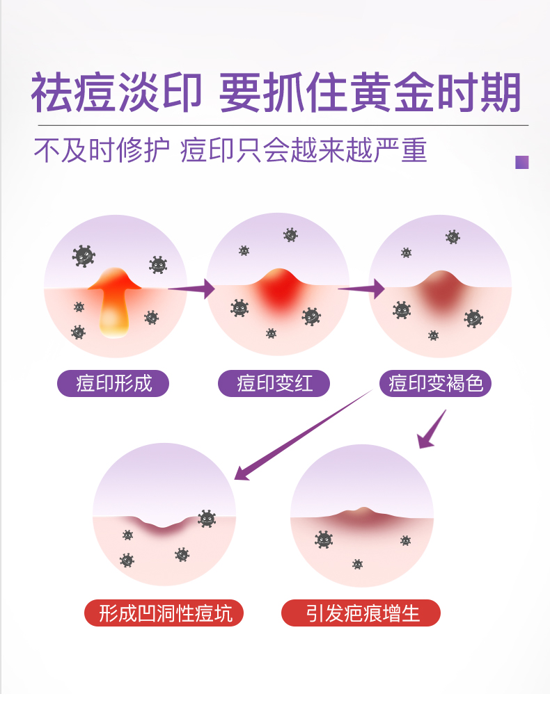 贺柏圣祛痘淡印片+B族维生素淡印修复片